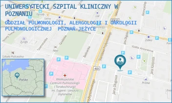 ODDZIAŁ PULMONOLOGII, ALERGOLOGII I ONKOLOGII PULMONOLOGICZNEJ - UNIWERSYTECKI SZPITAL KLINICZNY W POZNANIU - AUGUSTYNA SZAMARZEWSKIEGO 84,  POZNAŃ-JEŻYCE